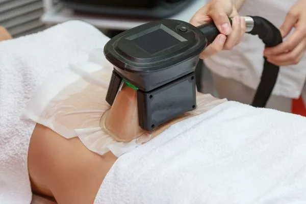 Image of person having fat freezing treatment to help weight gain Wisley
