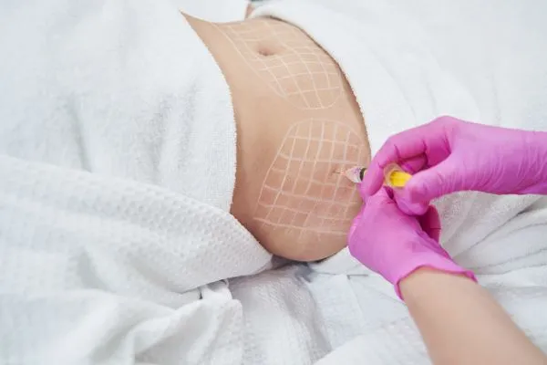 image of fat dissolving injections on love handles to help combat weight gain Wisley