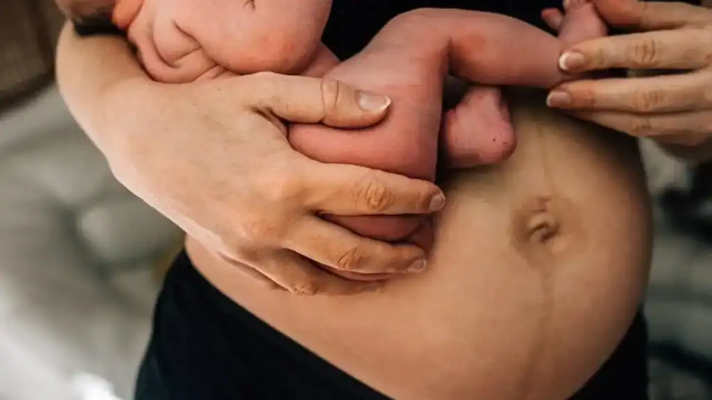 Why Is My Stomach Still Big After Pregnancy Wisley?